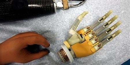 Británica se amputará una mano para implantarse una biónica